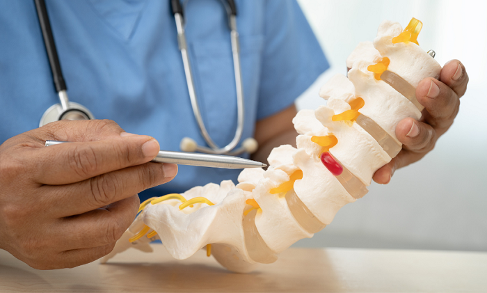 Early Signs of Ankylosing Spondylitis